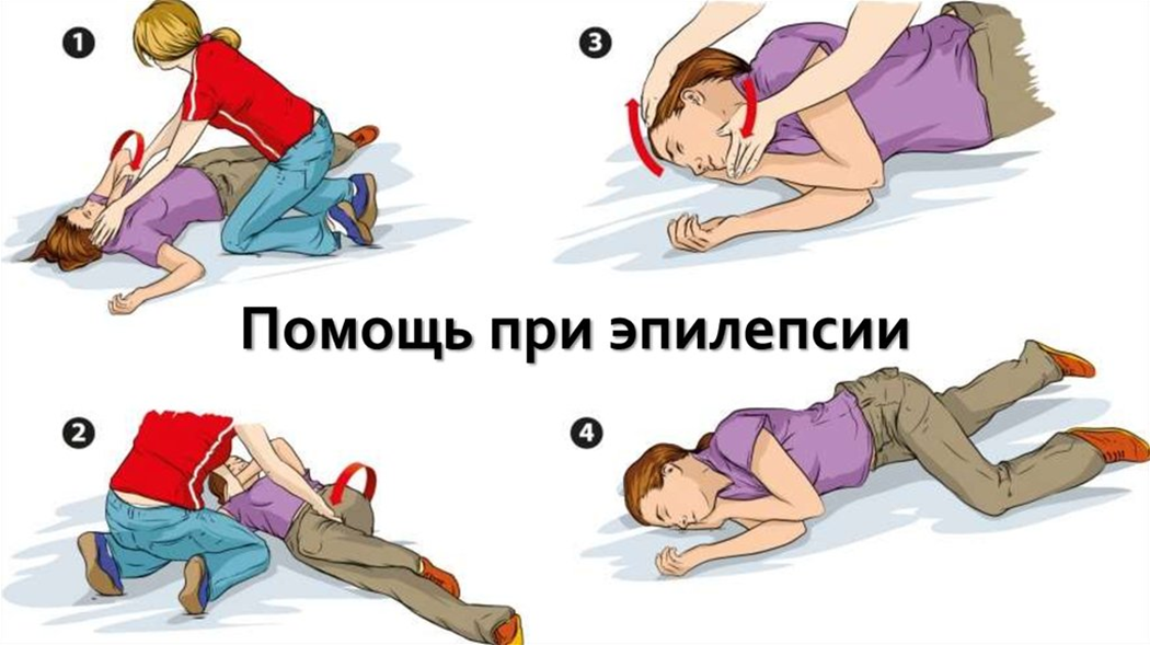 Эпилепсия и травмы